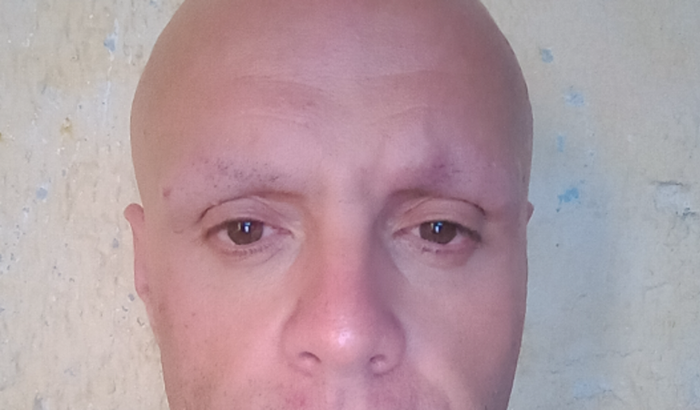 Ajuda Pará um Proletário Doente(Câncer)