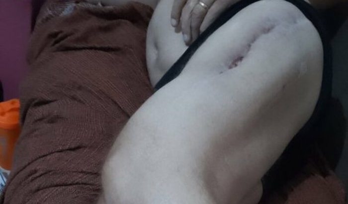 Ajude Claudemir a voltar a andar