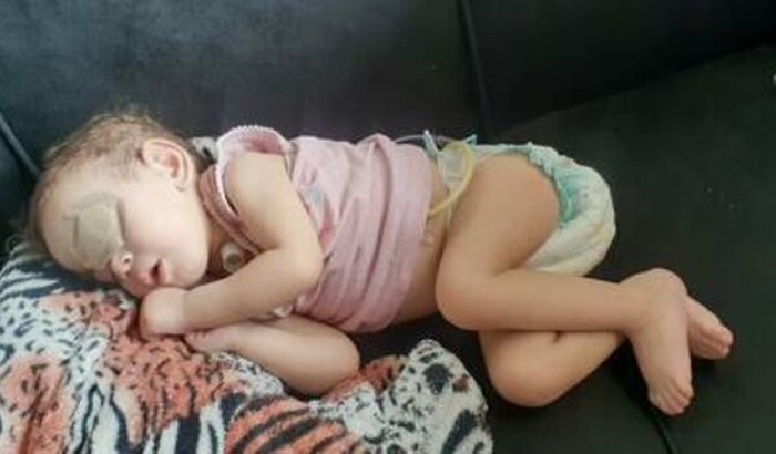 Ajude na compra do leite especial da minha Ana Livia 