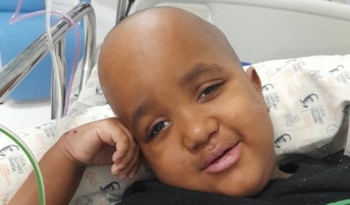  compra a Dieta de alto custo De enzo Rafael que tem Hidrocefalia é se alimentar por Sonda