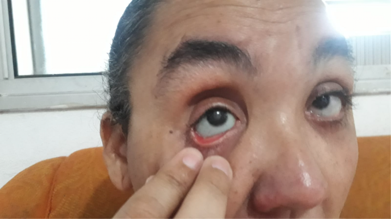 "Contribua para a prótese ocular da Lucy: Ajude-nos a ver a vida com mais clareza"