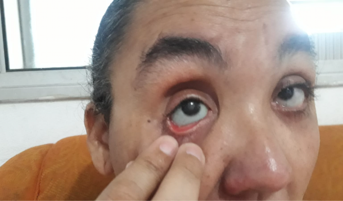 "Contribua para a prótese ocular da Lucy: Ajude-nos a ver a vida com mais clareza"