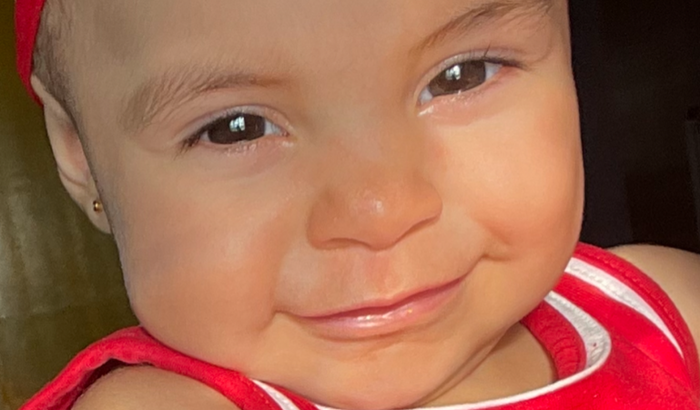 Cirurgia e Fisioterapia lipomielocele Ajude Ana Cecília