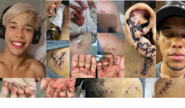 Ajude Nick Fontana, vítima de 38 facadas estado Grave.