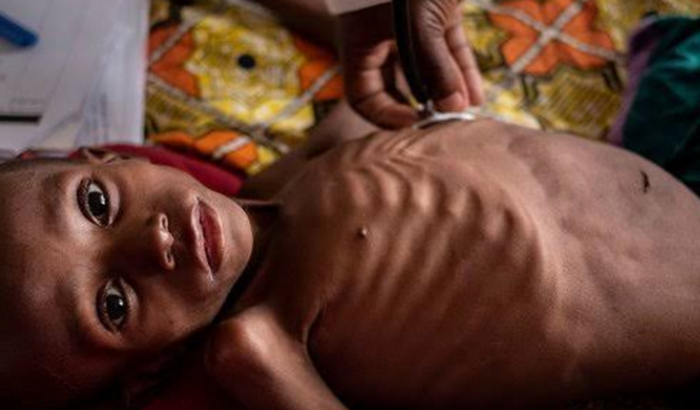 MISSÃO (crianças) ÁFRICA🥺