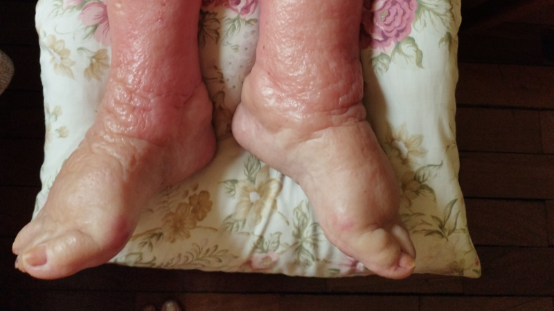 imagem da vaquinha Ajuda para remédio e calcinha Geriatra para idosa