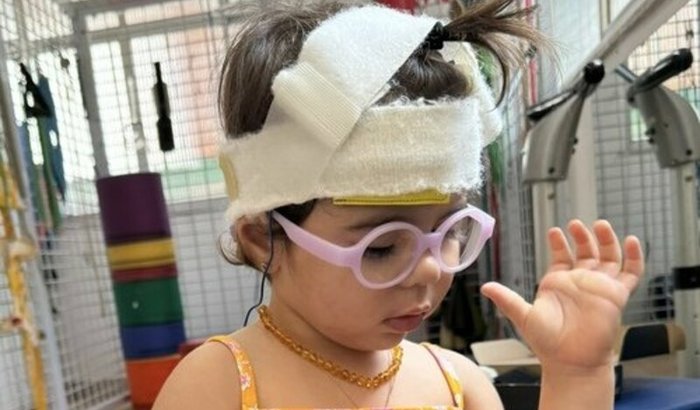 Ajude Helena a fazer a estimulação transcraniana.