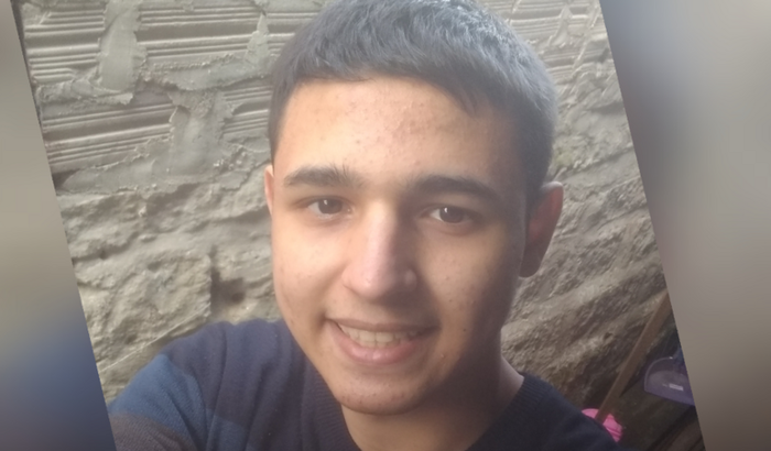 Compra de lente escleral