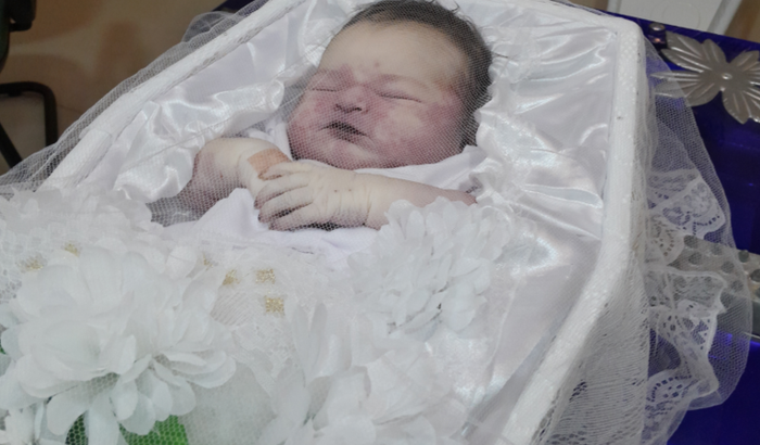 Cobrir gastos da internação no hospital em que minha filha recém nascida morreu.