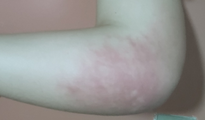 Exame médico (ressonância magnética)