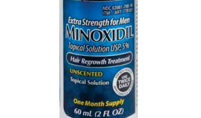 Ajuda para custear o tratamento com Minoxidiu do Breno Augusto.