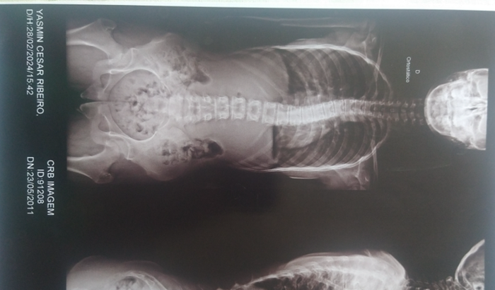 Fazer fisioterapia 