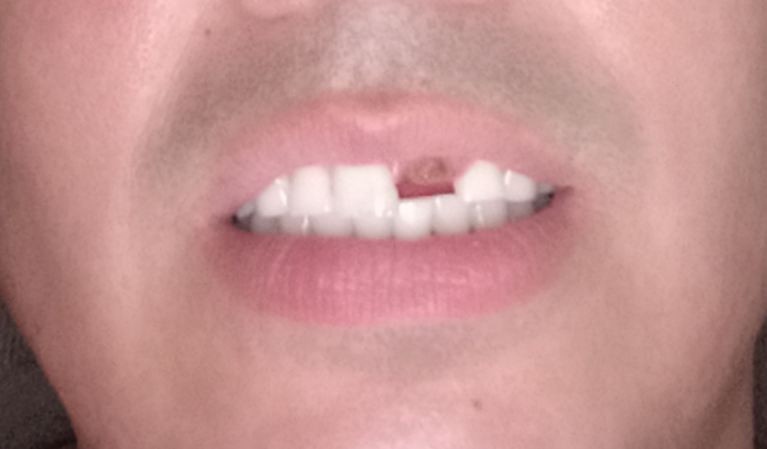 Ajuda para consertar um Sorriso 