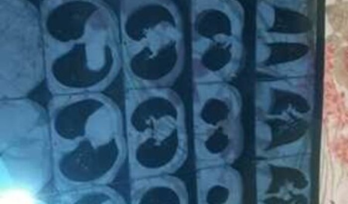 Consulta com pneumologista 