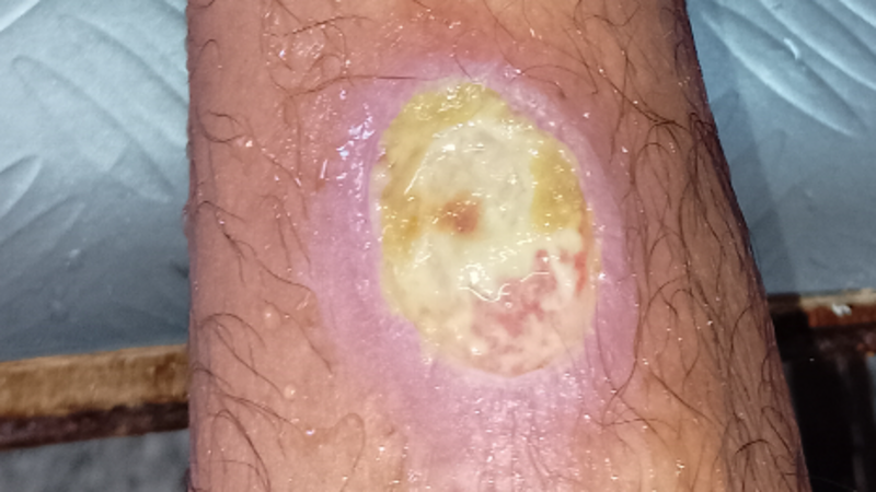 Ajuda ajeitar minha moto pra trampar 