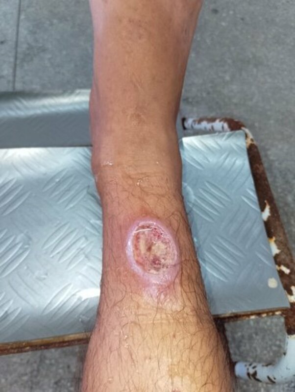 Ajuda no meu tratamento 