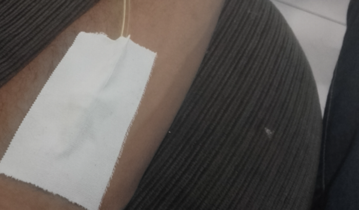 Desempregado pó problema de saúde