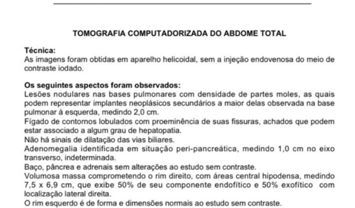 Tratamento do câncer 