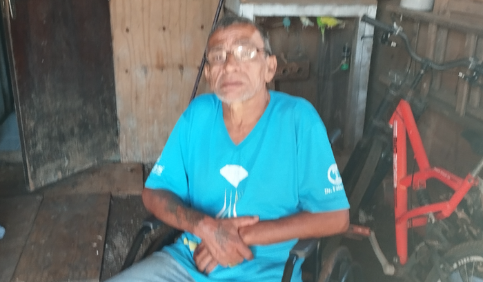 Comprar uma prótese 