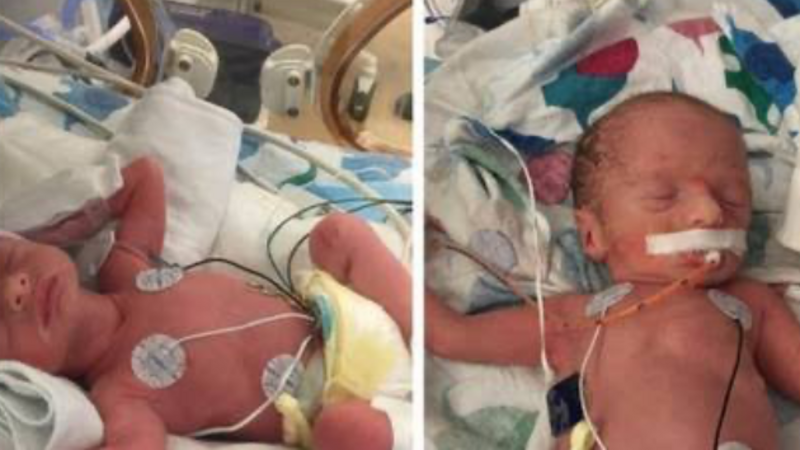 Ajudar uma amiga que deu luz a dois bebês prematuro