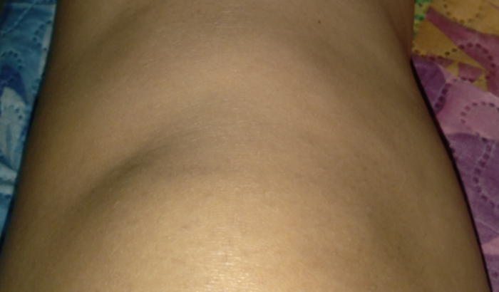 Em prol da minha cirurgia do joelho