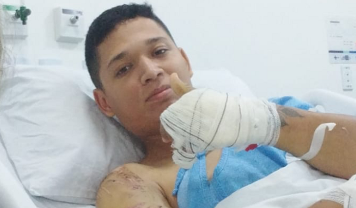 Prótese mecânica para Cláudio 
