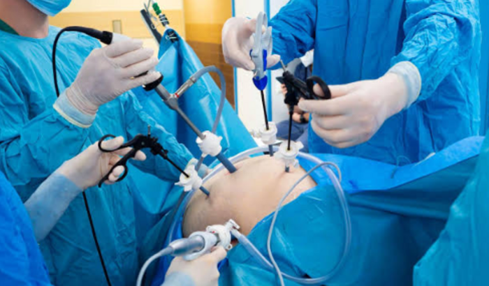 Cirurgia bariátrica. 