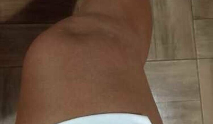 Cirurgia da Rosi
