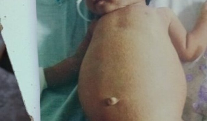 Ajude essa criança fazer essa cirurgia 