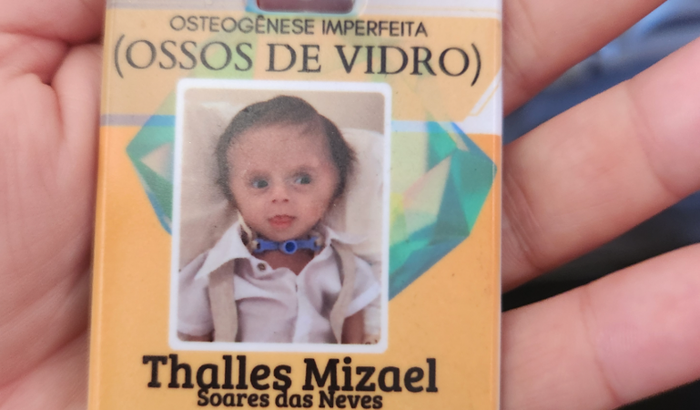 Ajudar os exames de traqueia e roupas Mizael ossos de vidro