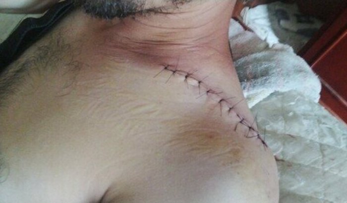 Ajuda na recuperação da minha cravicola