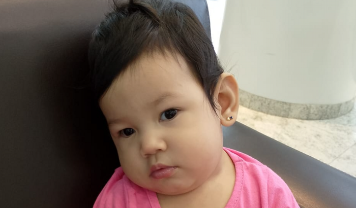 Arrecadação para cirurgia de catarata congênita