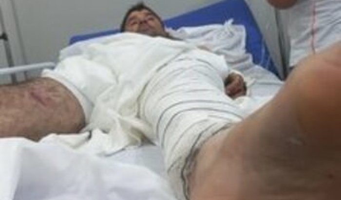 Ajuda em prol do Jeremias que sofreu um acidente e quebrou o fêmur e precisa operar urgente 