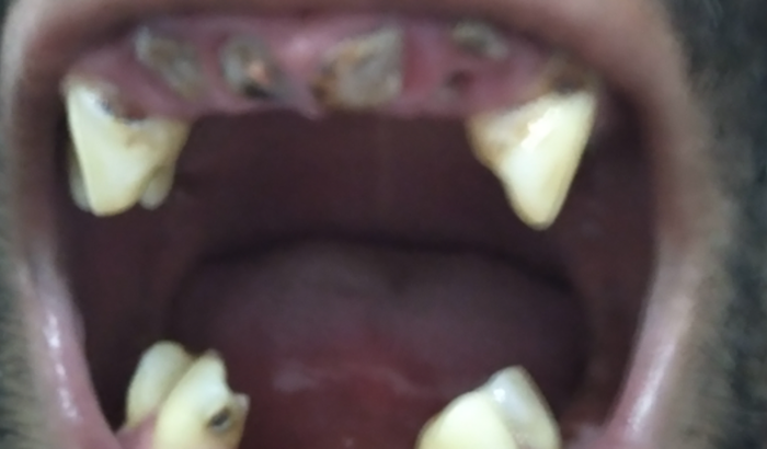 Tratamento odontológico 