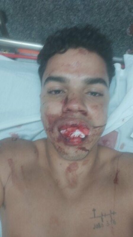 Colocar meus Dentes de volta..