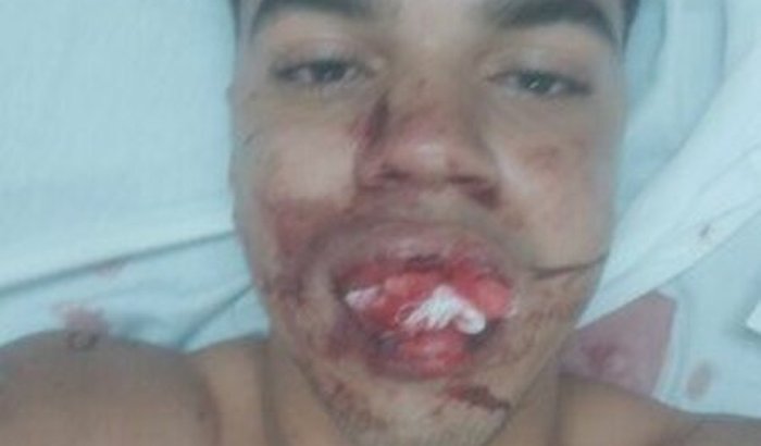 Colocar meus Dentes de volta..