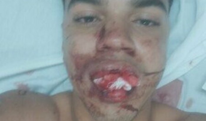 Colocar meus Dentes de volta..