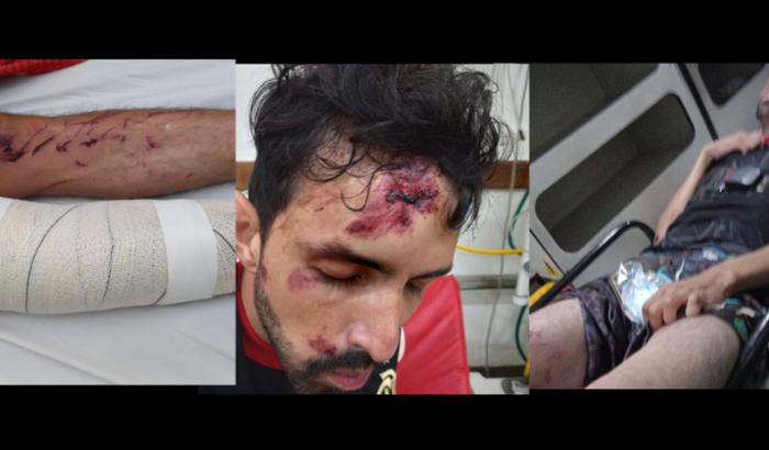 Ajude um motoboy acidentado