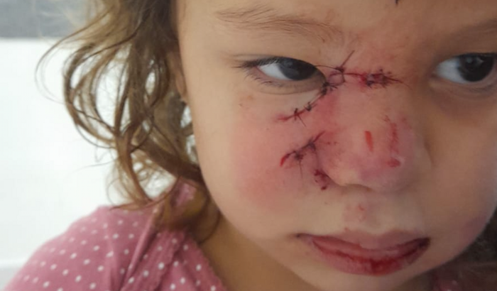 Pagar advogado para minha filha que é portadora de TEA e TDHA