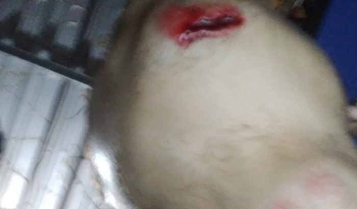 Ajuda para comcertar minha moto que sofri 2 acidentes 