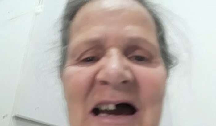 Vamos ajudar Célia Regina tratamento dentario