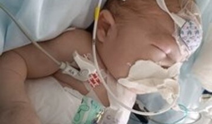 Anna Liz Vitória (cardiopata)