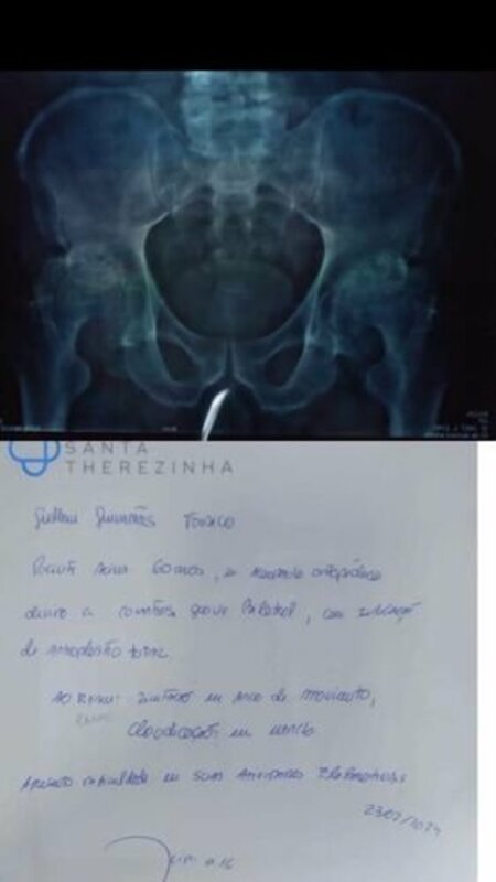 imagem da vaquinha Ajuda para cirurgia para o quadril.