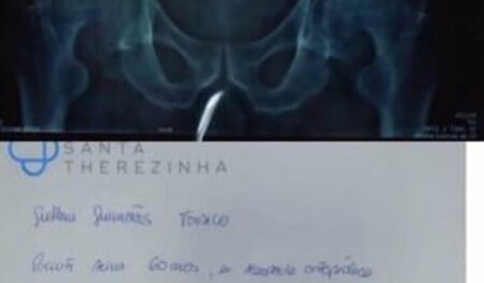 Ajuda para cirurgia para o quadril.