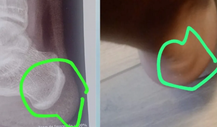 Ajude Rafael  voltar a correr 