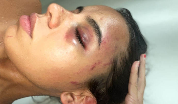 Justo judicial por agressão pelo meu ex companheiro 