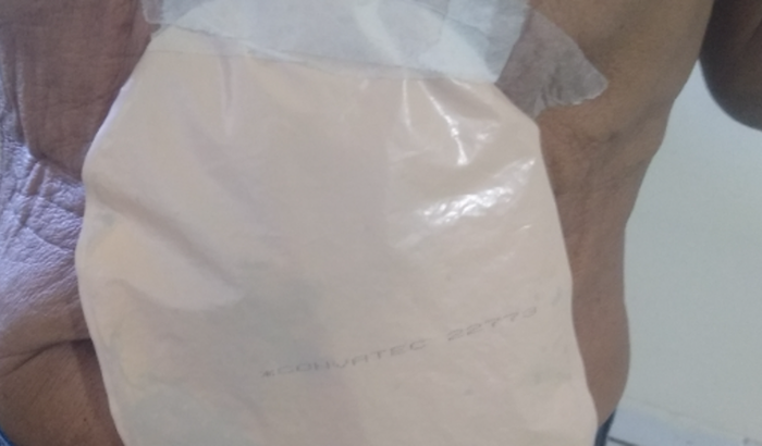 Ajudar estou com câncer no reto