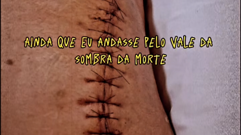 Pós operatório de um amigo 