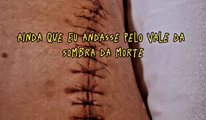 Pós operatório de um amigo 