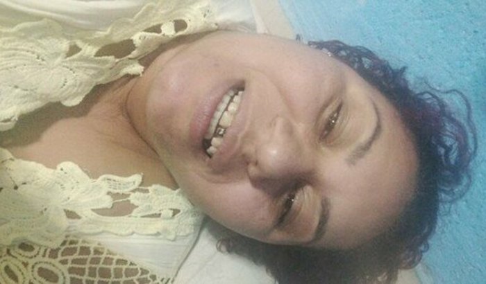 Ajuda a arrumar meu dente 